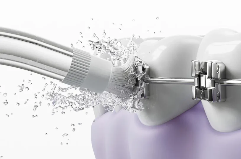 Xiaomi Mijia Smart Water Flosser Pro